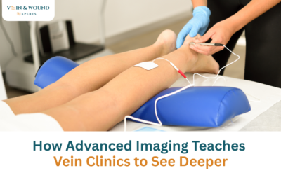 How Advanced Imaging Teaches Vein Clinics to See Deeper