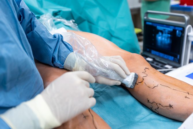 Patient meeting with a vein specialist.