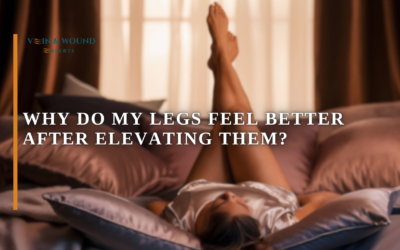 Why Do My Legs Feel Better After Elevating Them?