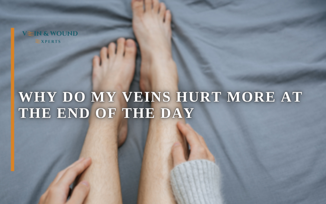 Why Do My Veins Hurt More at the End of the Day
