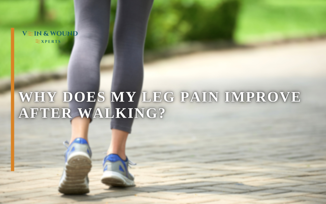 Why Does My Leg Pain Improve After Walking?