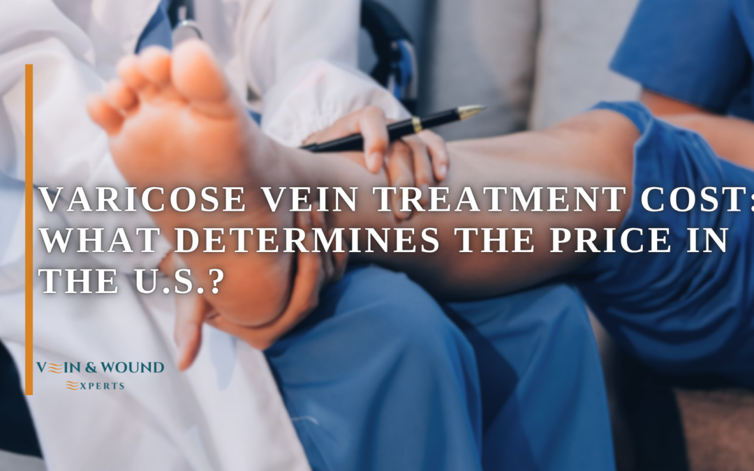 Varicose Vein Treatment Cost: What Determines the Price in the U.S.?