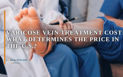 Varicose Vein Treatment Cost: What Determines the Price in the U.S.?