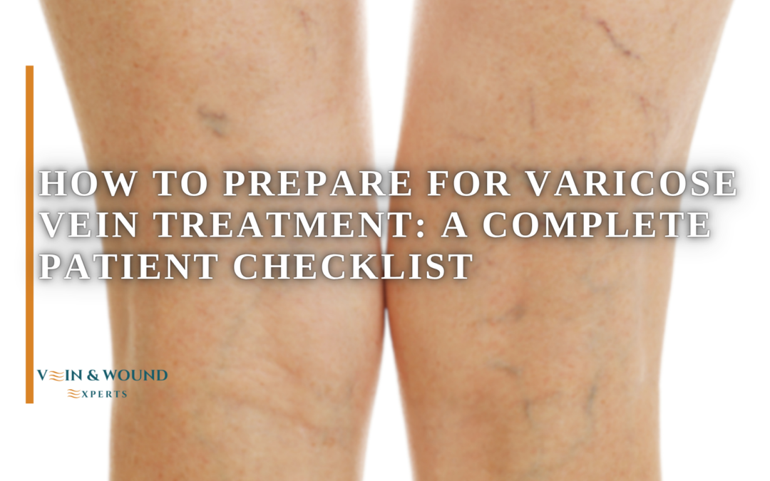 How to Prepare for Varicose Vein Treatment: A Complete Patient Checklist