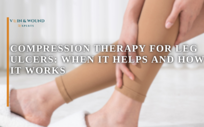 Compression Therapy for Leg Ulcers: When It Helps and How It Works