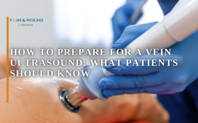 How to Prepare for a Vein Ultrasound: What Patients Should Know