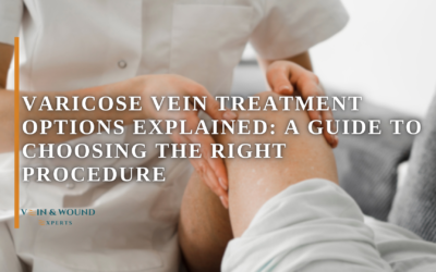 Varicose Vein Treatment Options Explained: A Guide to Choosing the Right Procedure