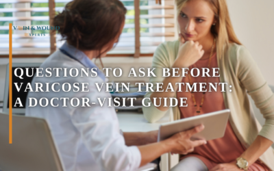 Questions to Ask Before Varicose Vein Treatment: A Doctor-Visit Guide