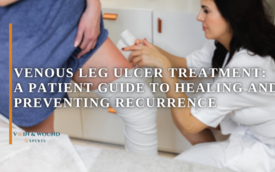 Venous Leg Ulcer Treatment: A Patient Guide to Healing and Preventing Recurrence
