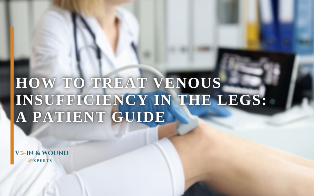 How to Treat Venous Insufficiency in the Legs: A Patient Guide