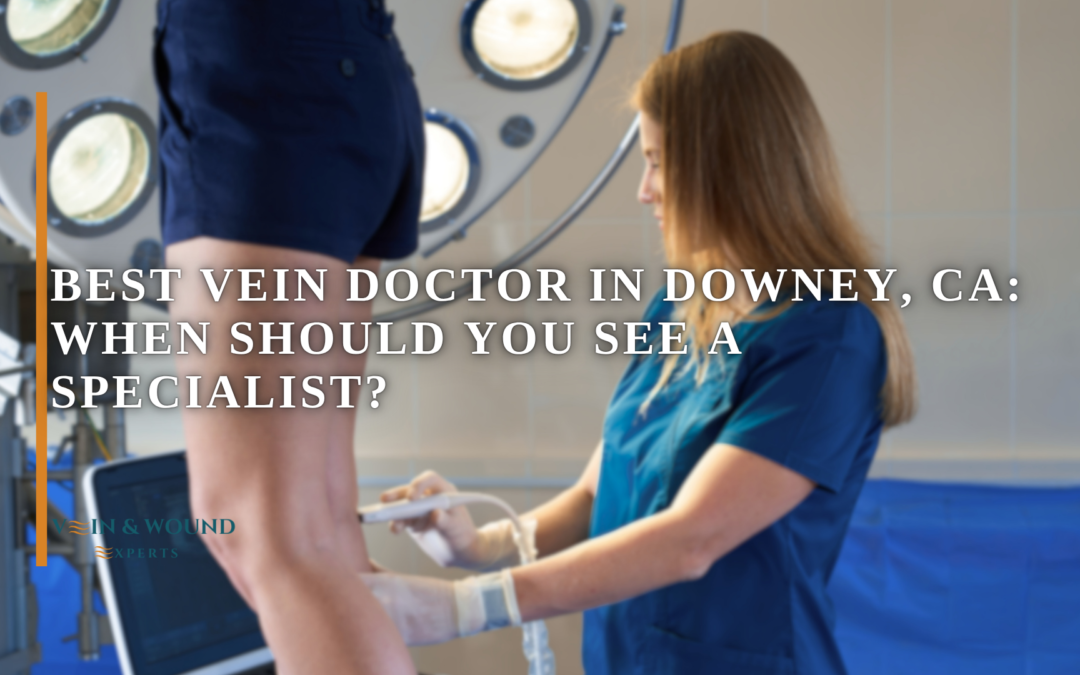Best Vein Doctor in Downey, CA: When Should You See a Specialist?