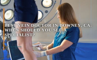 Best Vein Doctor in Downey, CA: When Should You See a Specialist?