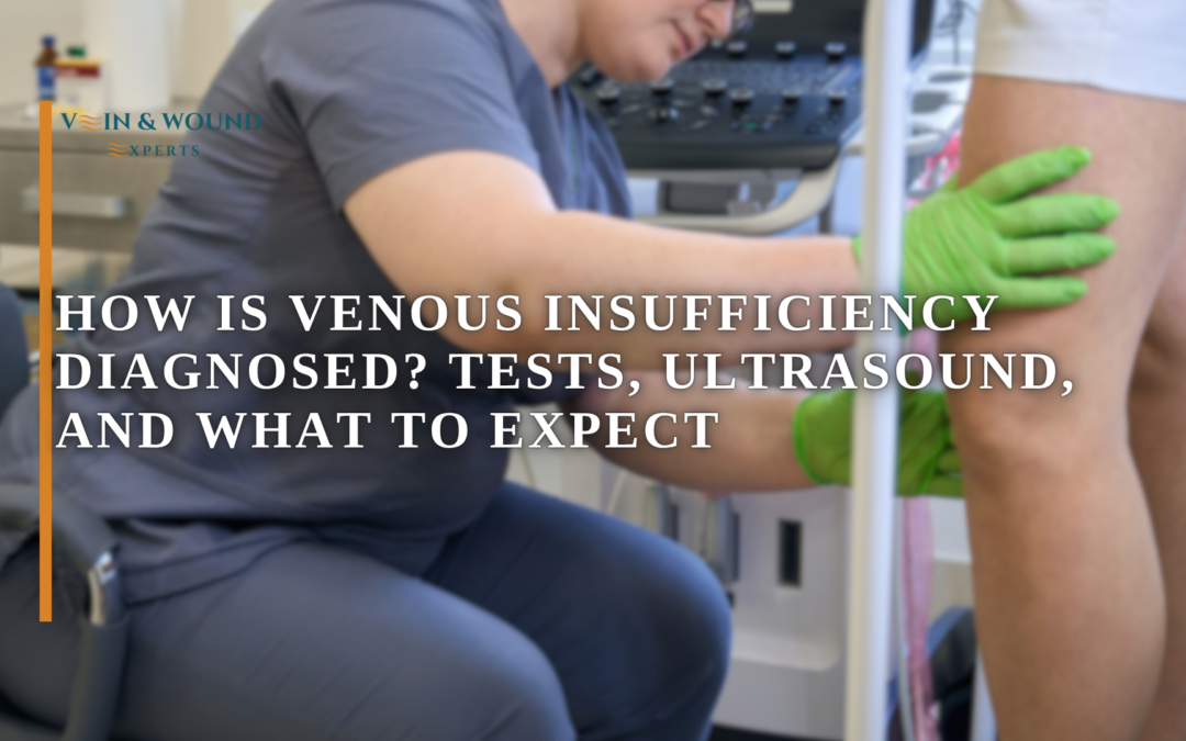 How Is Venous Insufficiency Diagnosed? Tests, Ultrasound, and What to Expect