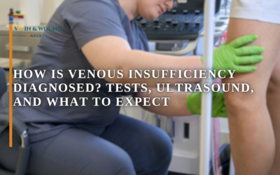 How Is Venous Insufficiency Diagnosed? Tests, Ultrasound, and What to Expect