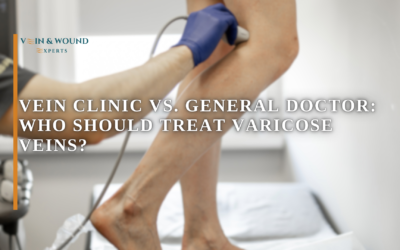 Vein Clinic vs. General Doctor: Who Should Treat Varicose Veins?