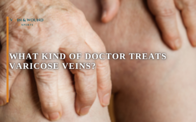 What Kind of Doctor Treats Varicose Veins?