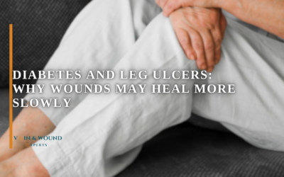 Diabetes and Leg Ulcers: Why Wounds May Heal More Slowly