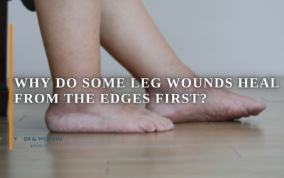 Why Do Some Leg Wounds Heal From the Edges First?