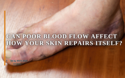 Can Poor Blood Flow Affect How Your Skin Repairs Itself?