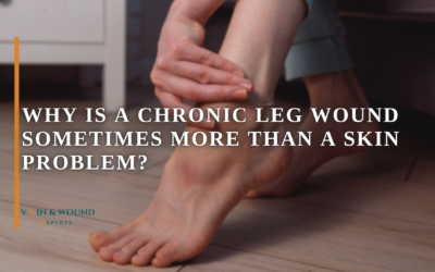 Why Is a Chronic Leg Wound Sometimes More Than a Skin Problem?